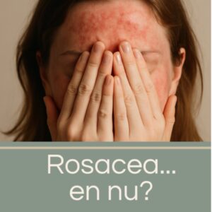 Boek Rosacea...en nu?